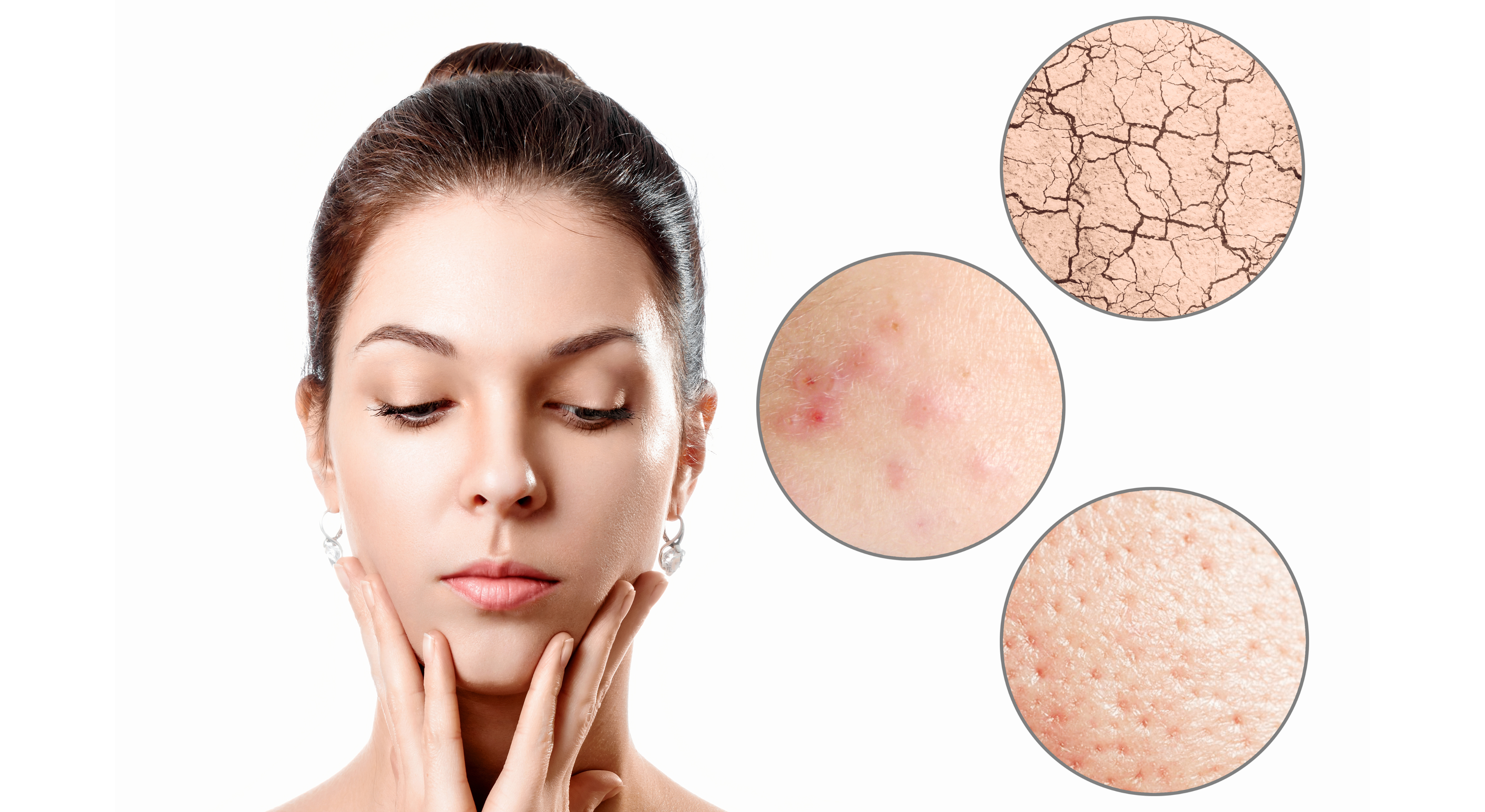 Drying Skin 5 Easy Ways to Improve Dry Skin